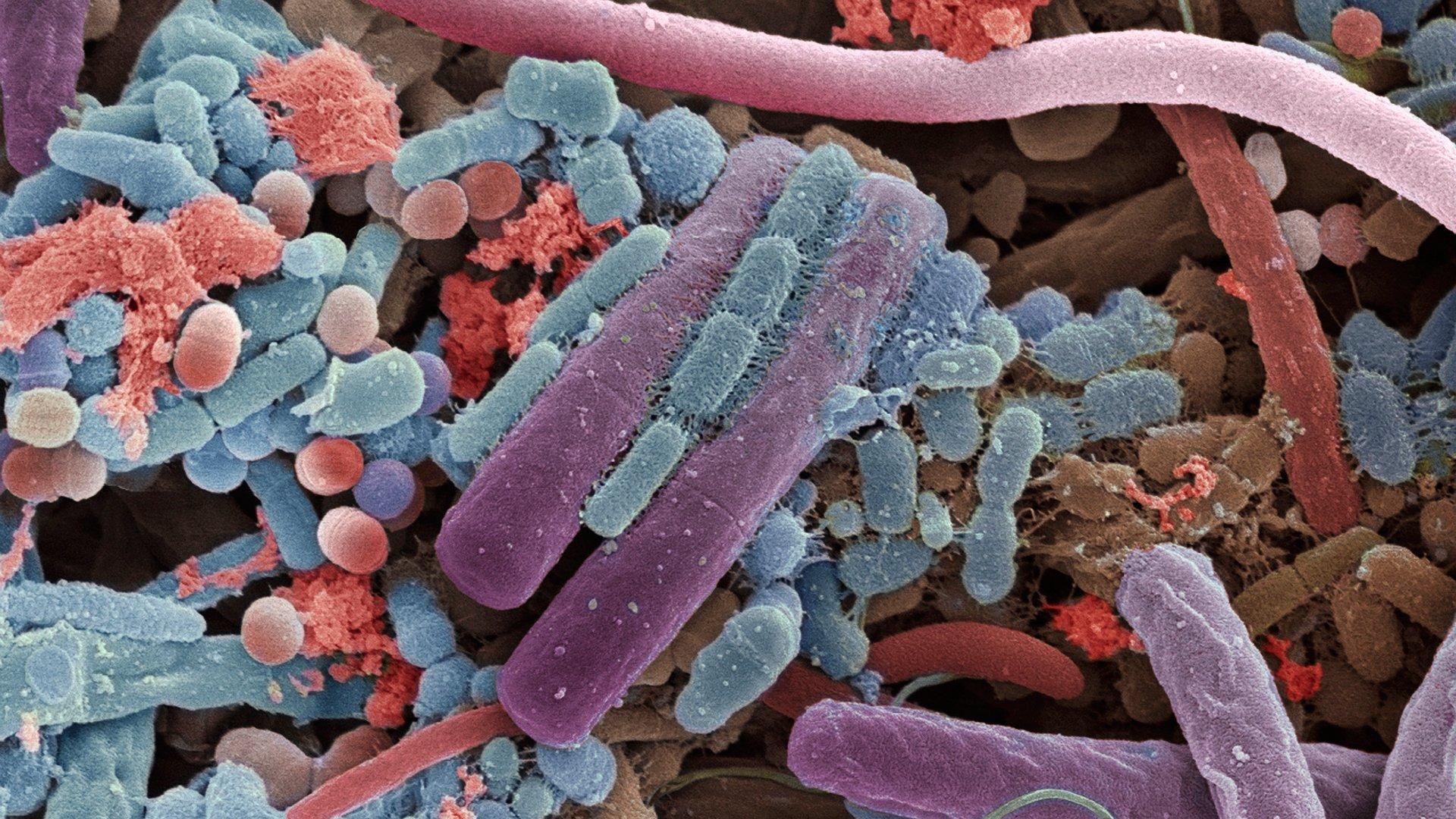 Бактерии домашних условиях. Микробиота кишечника микробиология. Микробиота кишечника под микроскопом. Бактерии под микроскопом. Микробы в микроскопе.